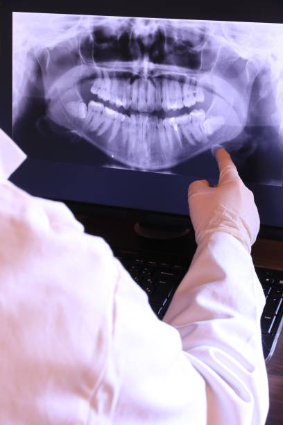 Best Broken or Chipped Tooth Repair in Berry Creek, CA